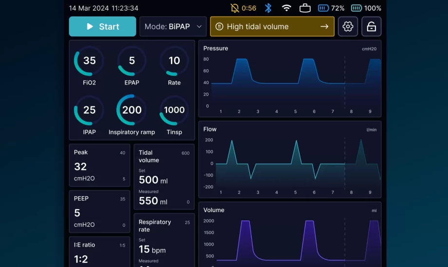 Ventilator Data Application